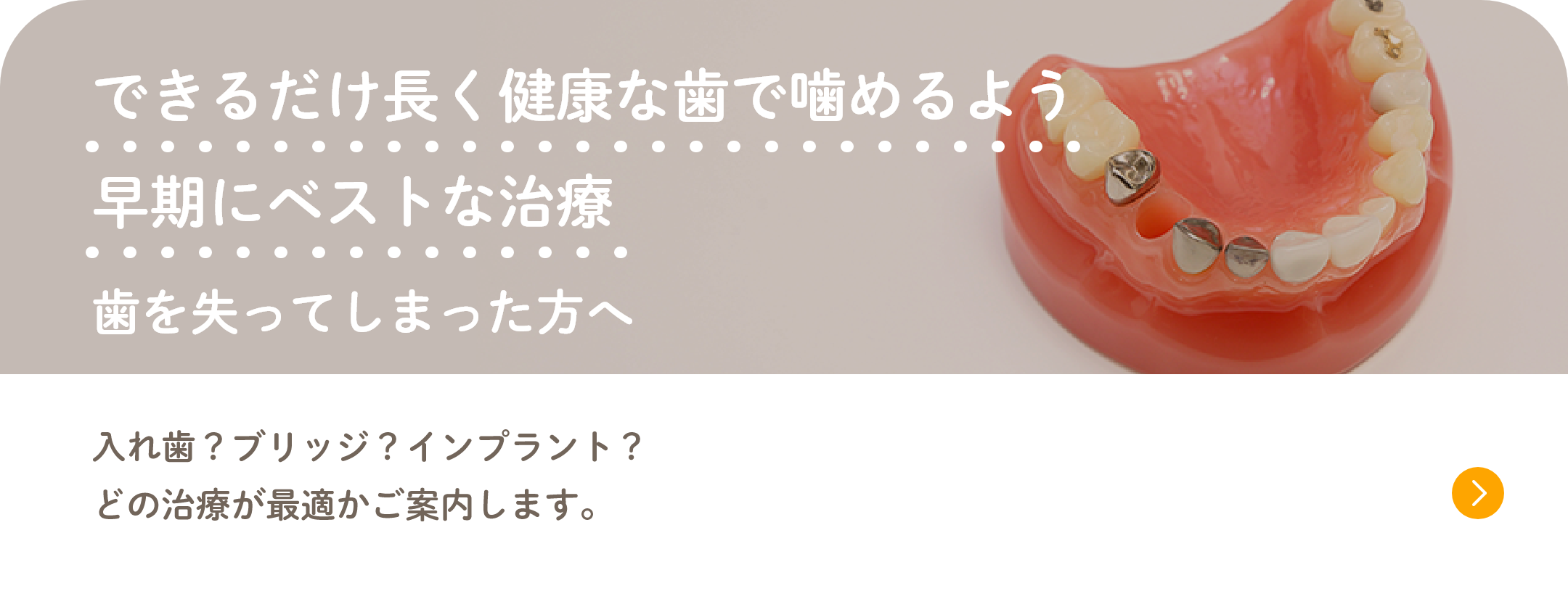 できるだけ長く健康な歯で噛めるよう早期にベストな治療 歯を失ってしまった方へ 入れ歯？ブリッジ？インプラント？どの治療が最適かご案内します。